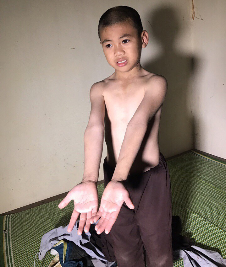 thuc_hu_vu_viec_be_trai_mo_coi_bi_su_thay_danh_bam_tim_nguoiphattu_com5.jpg