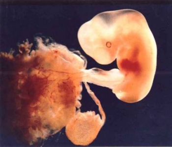 Hỏi - Đáp về phá thai và vong linh thai nhi