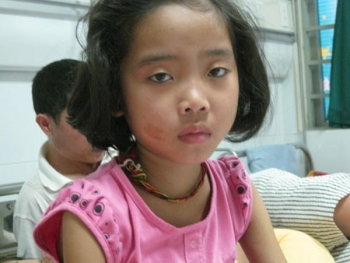 Nỗi khốn khó của cô bé dân tộc Thái nhiễm virus EBV