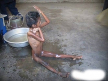 Một ngôi chùa nuôi dưỡng cô bé sống như “người rừng” tại Khánh Hòa